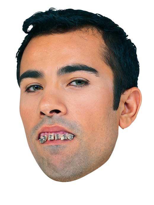 Braces Teeth&Putty - JJ's Party House